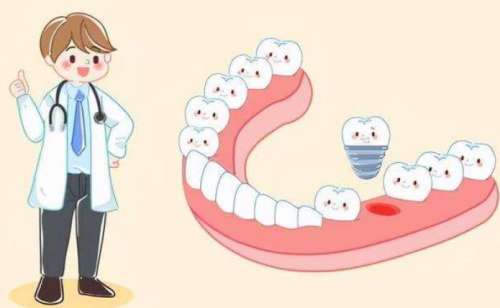 宁波种一颗牙大概要多少钱？手术特点/种植牙过程/注意事项