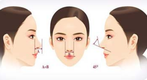 肋软骨隆鼻的原理是什么？肋软骨隆鼻的优缺点有哪些？