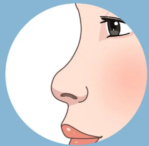 隆鼻的风险和副作用是什么？掌握好这篇教你降低隆鼻风险！