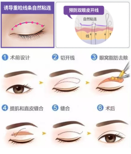 QQ浏览器截图20210908175257.png
