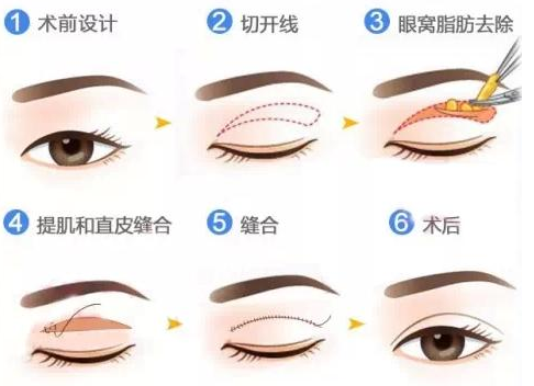 QQ浏览器截图20210908174718.png