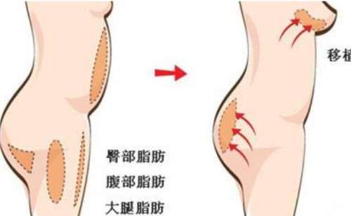胸部.jpg