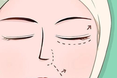 15.png