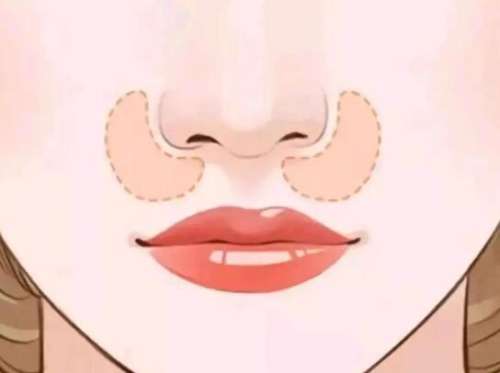 鼻基底.jpg