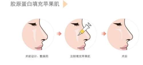 胶原蛋白.jpg