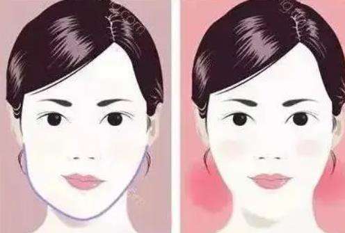脸一边大一边小怎么纠正.jpg