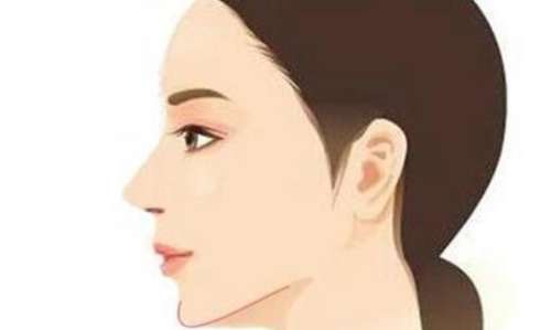 下颌角2.jpg 下颌角2.jpg