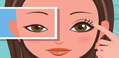 双眼皮25.jpg 双眼皮25.jpg