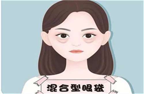 眼睛24 - 副本.jpg