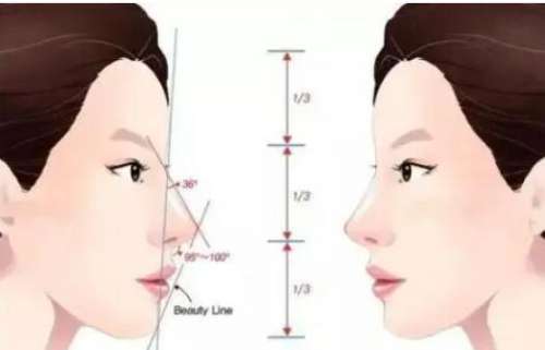 隆鼻动漫31.jpg 隆鼻动漫31.jpg