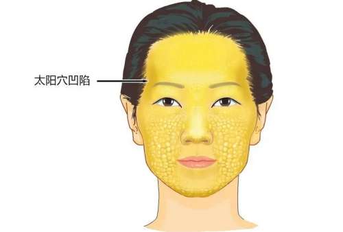 活细胞填充太阳凹陷.jpg