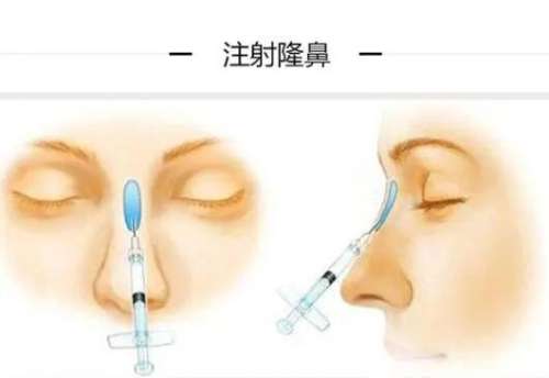 QQ截图20231025113523.jpg