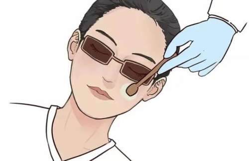光子嫩肤动漫20.jpg 光子嫩肤动漫20.jpg