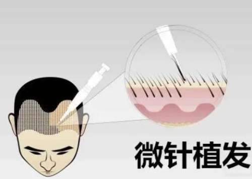 QQ截图20231107113642.jpg