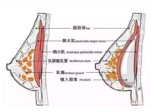 QQ截图20231116113003.jpg