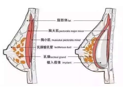 QQ截图20231117110409.jpg