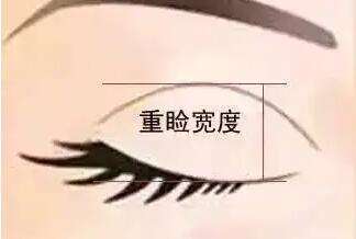 双眼皮 双眼皮