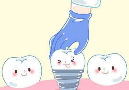 种植牙5.jpg