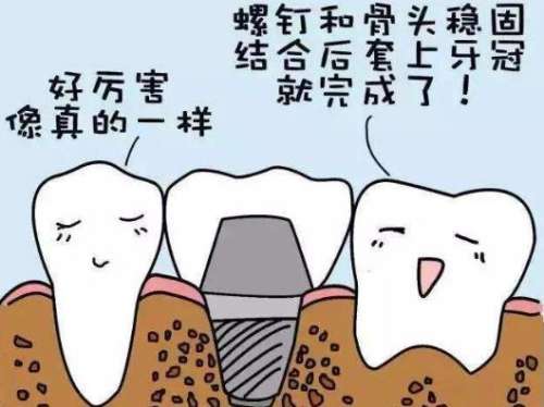 韩国登腾种植牙3900元一颗含基台吗？是否含基台可以具体的咨询手术医生