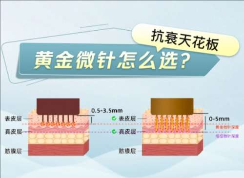 potenza黄金微针价位是多少?功效是什么?