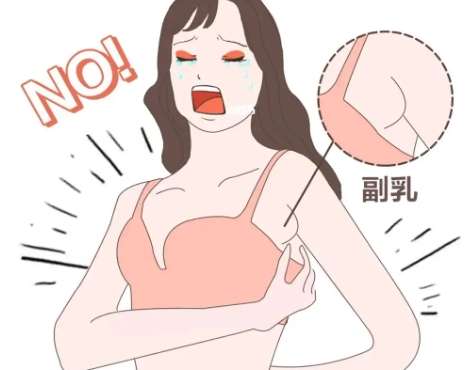 副乳手术动漫.jpg