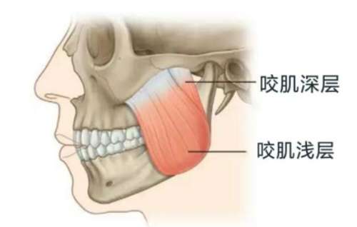 下颌角