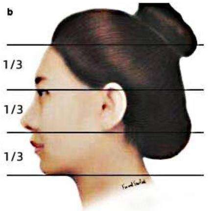 磨骨手术0