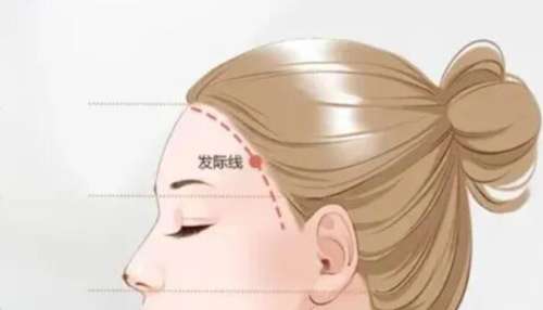发际线 发际线