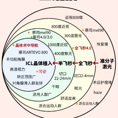 近视眼 近视眼