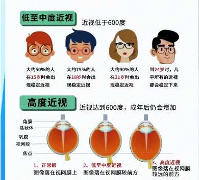 近视眼xx.jpg