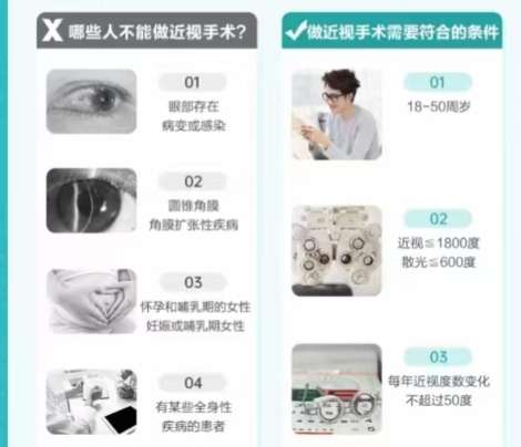 近视眼 近视眼