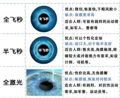 近视眼 近视眼