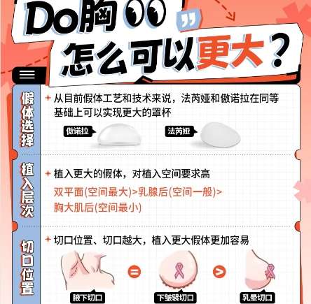 隆胸 隆胸