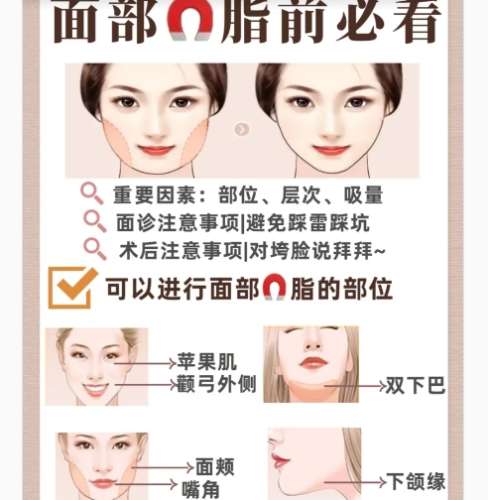 面吸 面吸