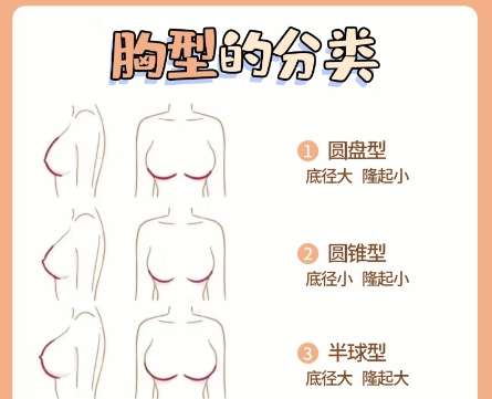隆胸 隆胸