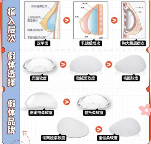 隆胸 隆胸