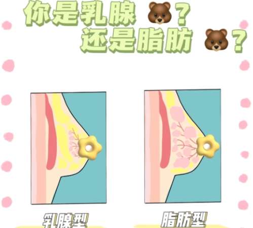 隆胸 隆胸
