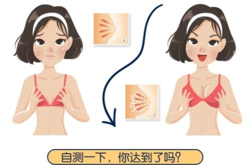 隆胸 隆胸
