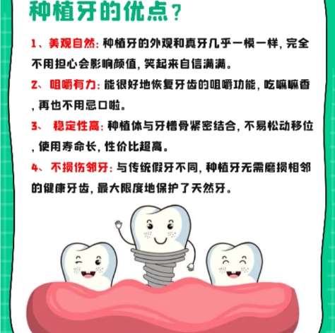 牙齿种植 牙齿种植