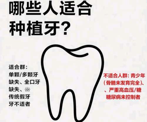 牙齿种植 牙齿种植