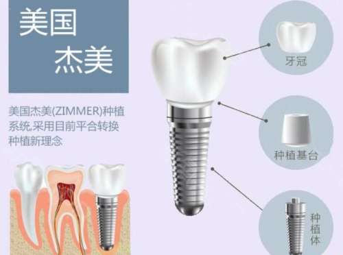 Zimmer Biomet(美国杰美) Zimmer Biomet(美国杰美)