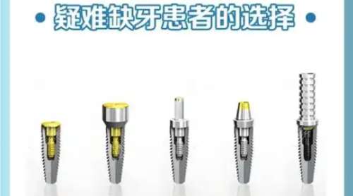 Nobel Biocare(瑞典诺贝尔) Nobel Biocare(瑞典诺贝尔)