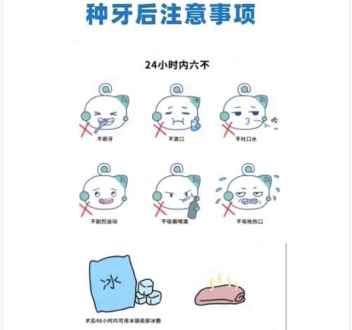牙齿种植 牙齿种植