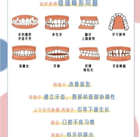 牙齿矫正 牙齿矫正