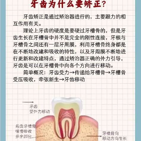 牙齿矫正 牙齿矫正