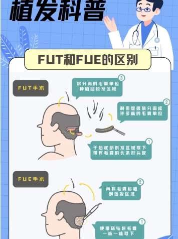 植发 植发