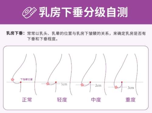 隆胸 隆胸