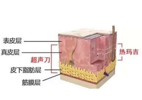 热玛吉1.jpg