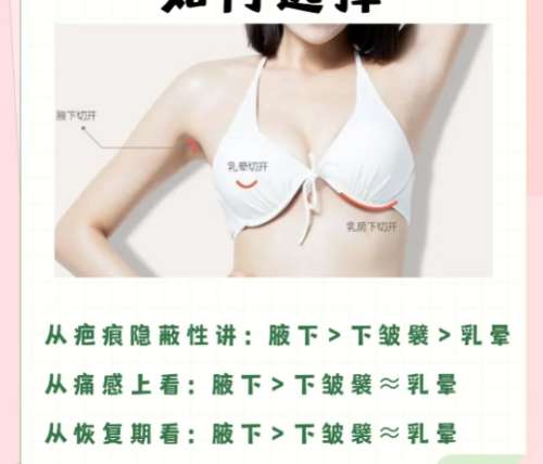 隆胸.jpg 隆胸.jpg