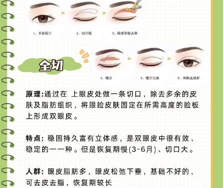 双眼皮 双眼皮